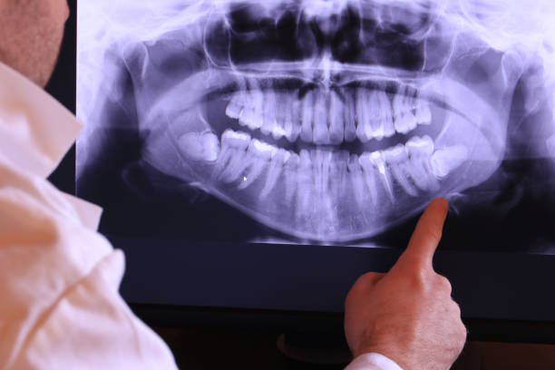 Best Tooth Infection Emergency Dentist  in Higginsville, MO