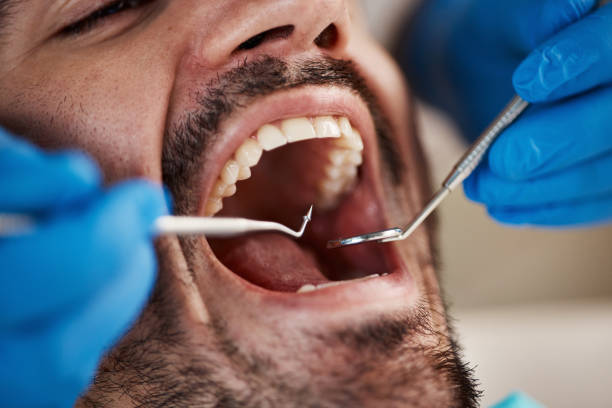 Best Emergency Gum Pain Relief  in Higginsville, MO
